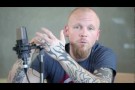 Ben Moody of Evanescence: My Transformation | Los Angeles | Hollywood | Beverly Hills | MetroMD