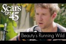 Scars on 45 - "Beauty's Running Wild" Live Acoustic Session